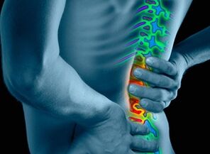 az osteochondrosis okai és tünetei