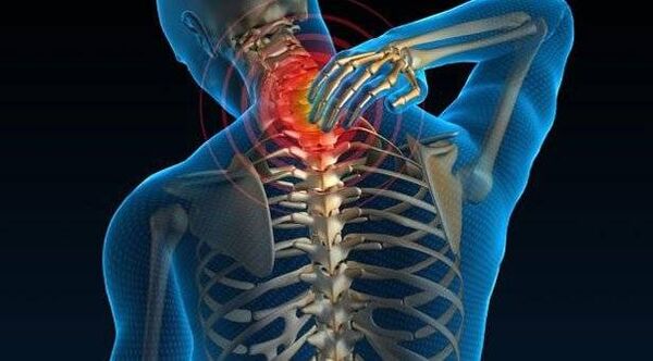 A gerinc osteocondritis